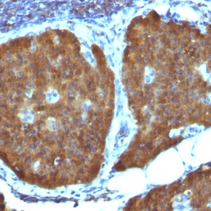 NSE gamma (Neuron Specific Enolase, gamma) (Neuroendocrine Marker); Clone ENO2/1462 (Concentrate)